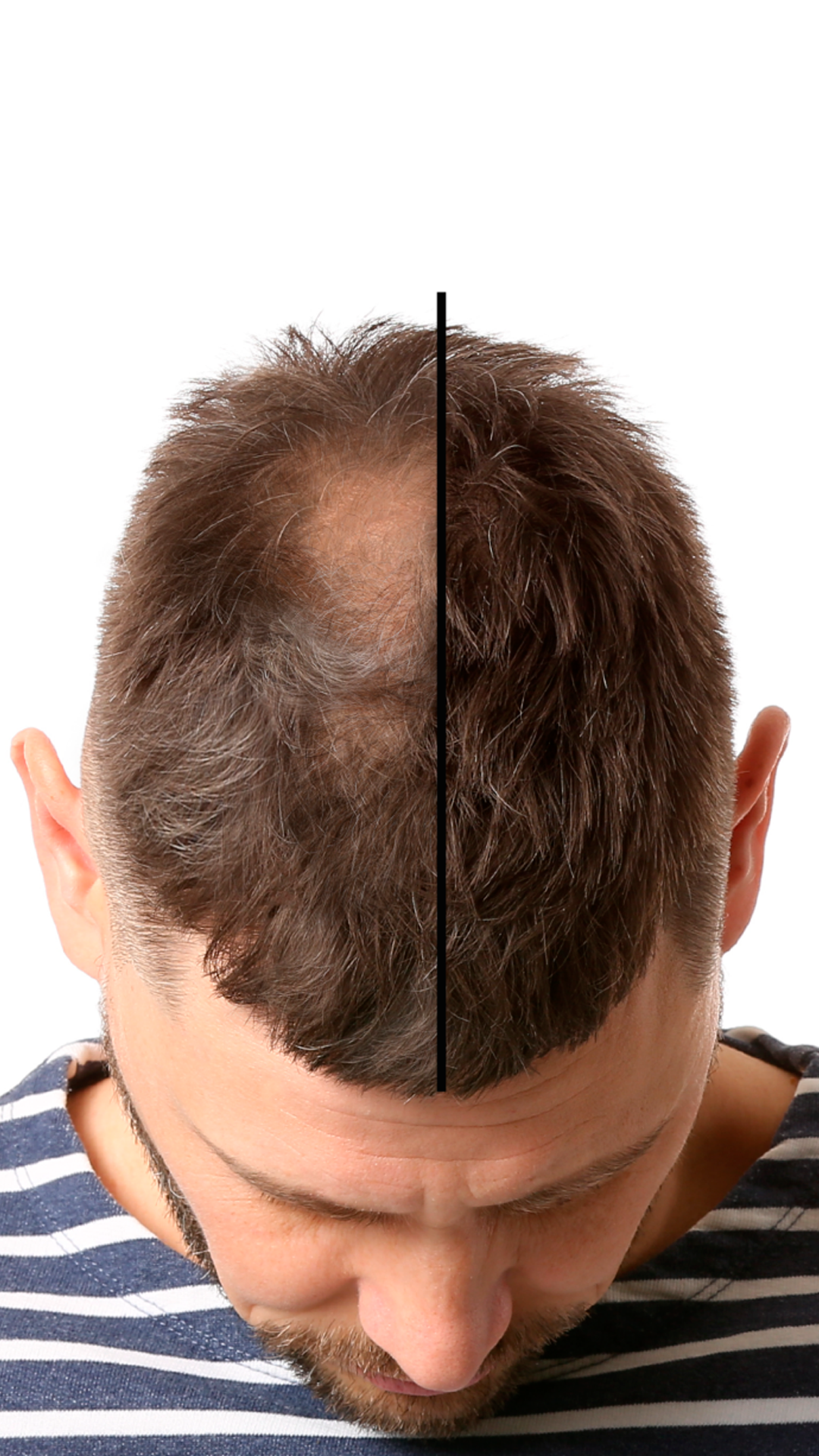 Antes e Depois